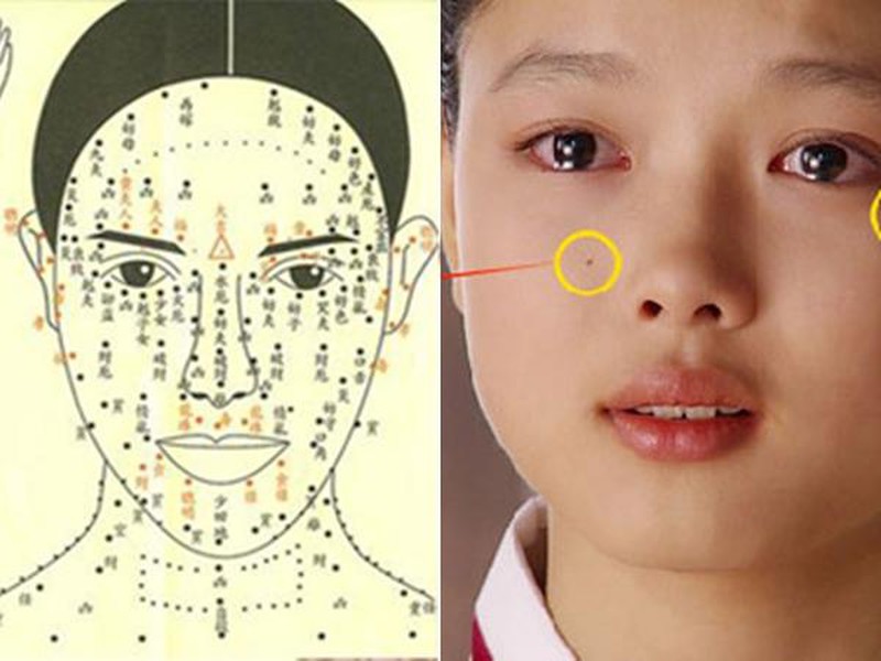 Phân tích nốt ruồi trên má nam và nữ