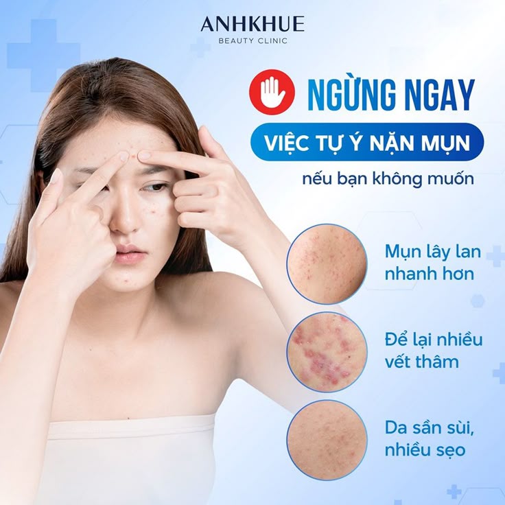Nốt ruồi nên giữ lại trên gương mặt