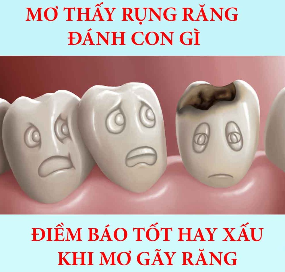 Mơ thấy rụng răng nên đánh con gì may mắn
