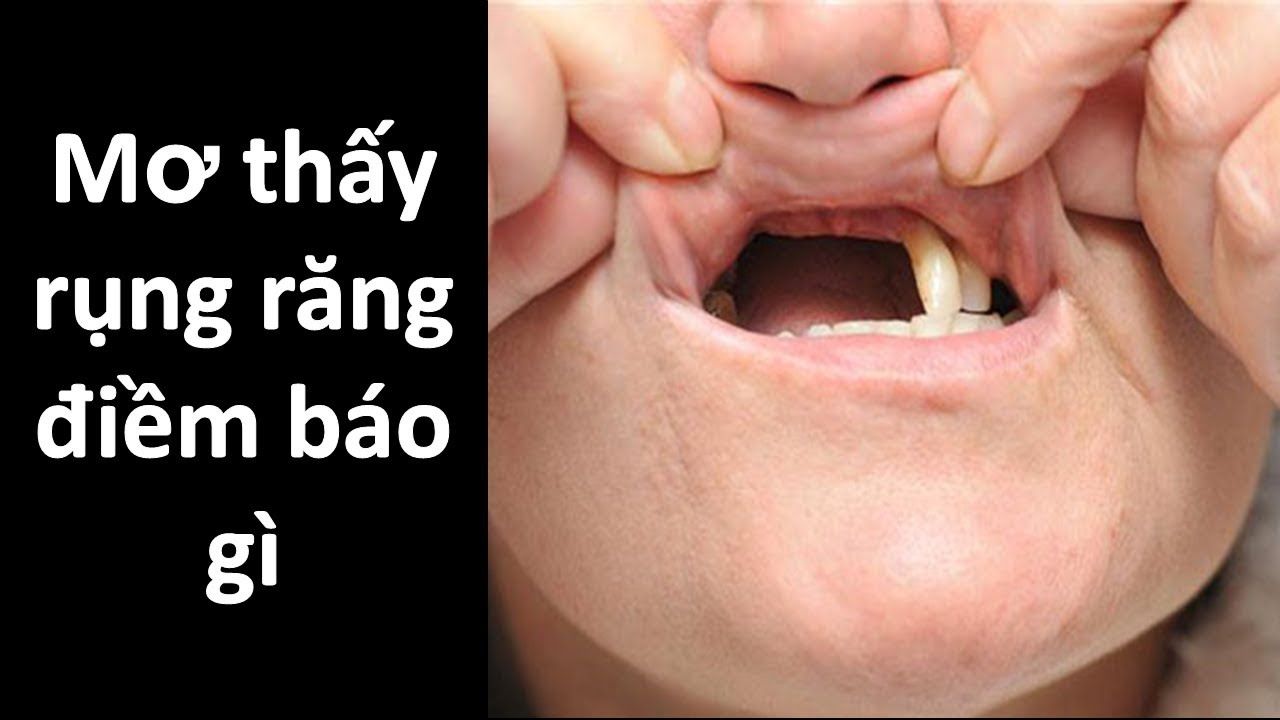 Mơ thấy rụng răng nên đánh con gì may mắn