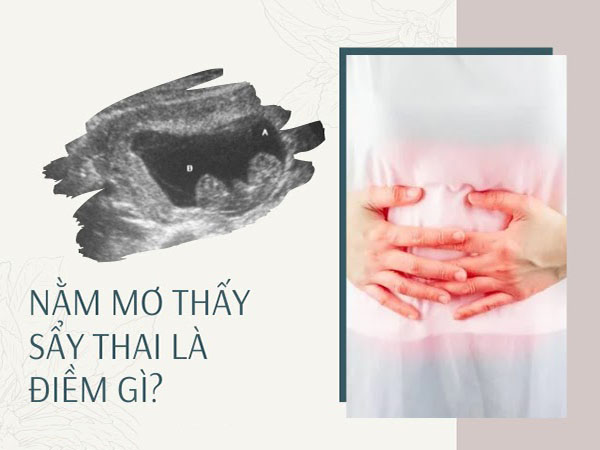 Phụ nữ mơ thấy có thai đánh đề số gì