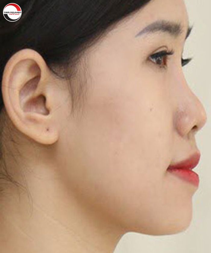 Lỗ mũi và ý nghĩa trong nhân tướng