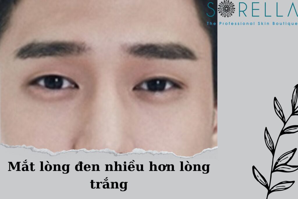 Minh họa đặc điểm mắt nam giới