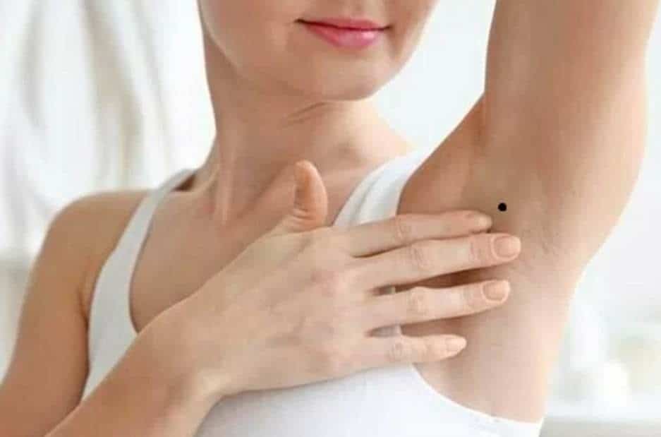 Các vị trí nốt ruồi ở nách nữ