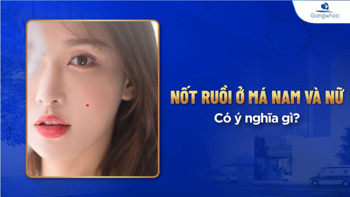 Nốt ruồi ở má nam và nữ