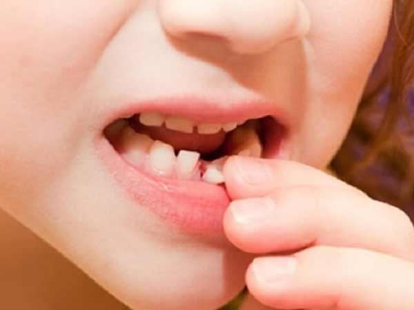 Mơ thấy nhổ răng đánh đề số mấy chuẩn nhất