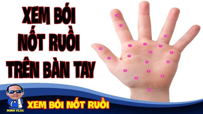 Nốt ruồi son lòng bàn tay tốt hay xấu