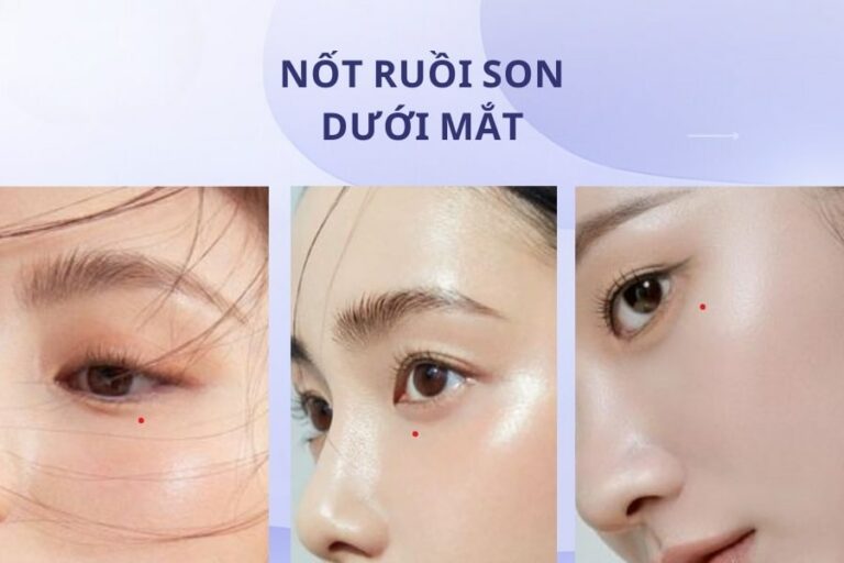 Ý nghĩa nốt ruồi son ở mắt nữ