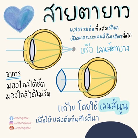 Hình ảnh nháy mắt phải ở người trẻ