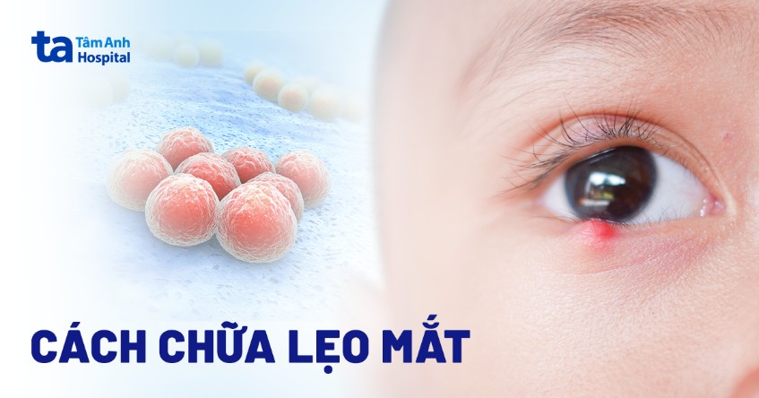 Mắt bị lẹo và dấu hiệu nhận biết