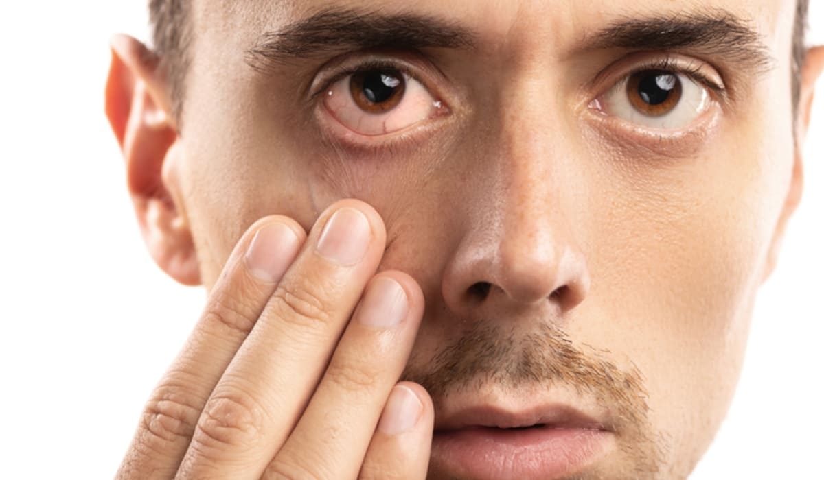 Chăm sóc mắt khi mắt phải giật