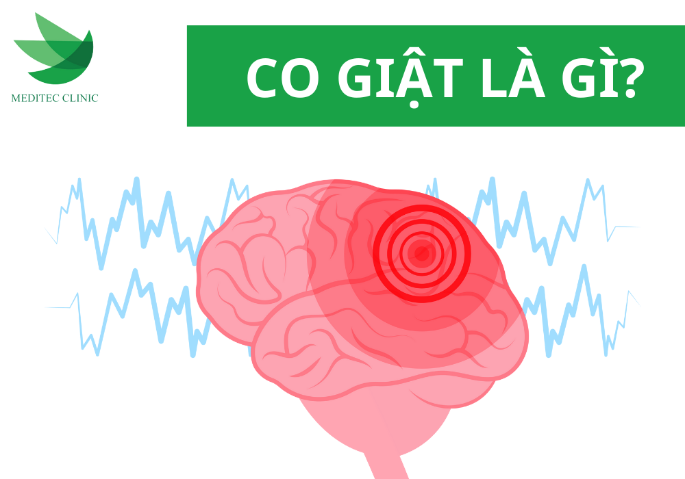 Biểu hiện co giật trên cơ thể người