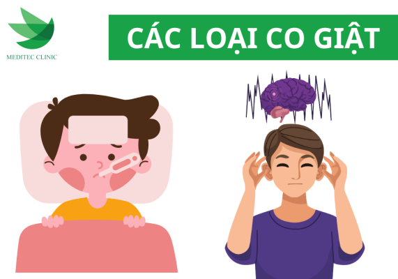 Co giật nhẹ thường gặp ở người lớn