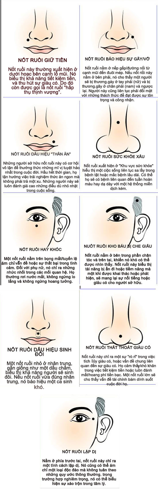 Các kiểu nốt ruồi quanh miệng