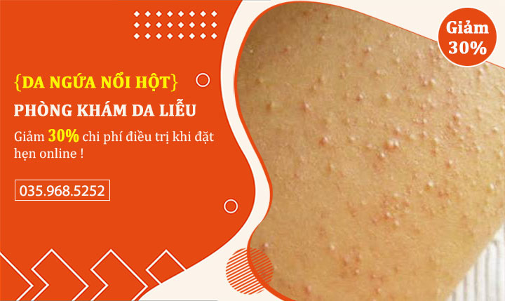 Da nổi hạt nhỏ giống da gà và ngứa