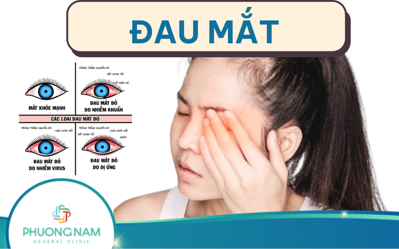 Triệu chứng đau mắt thường gặp