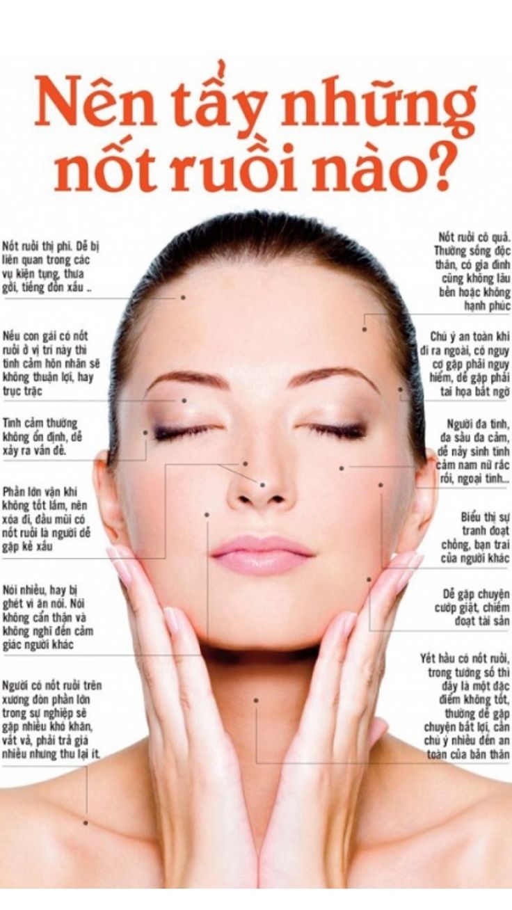 Nốt ruồi ở nách phải phụ nữ
