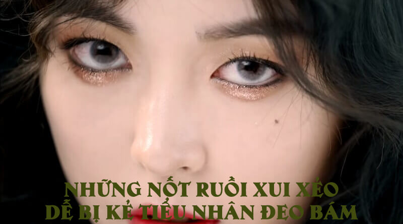 Các loại nốt ruồi dễ gặp tiểu nhân