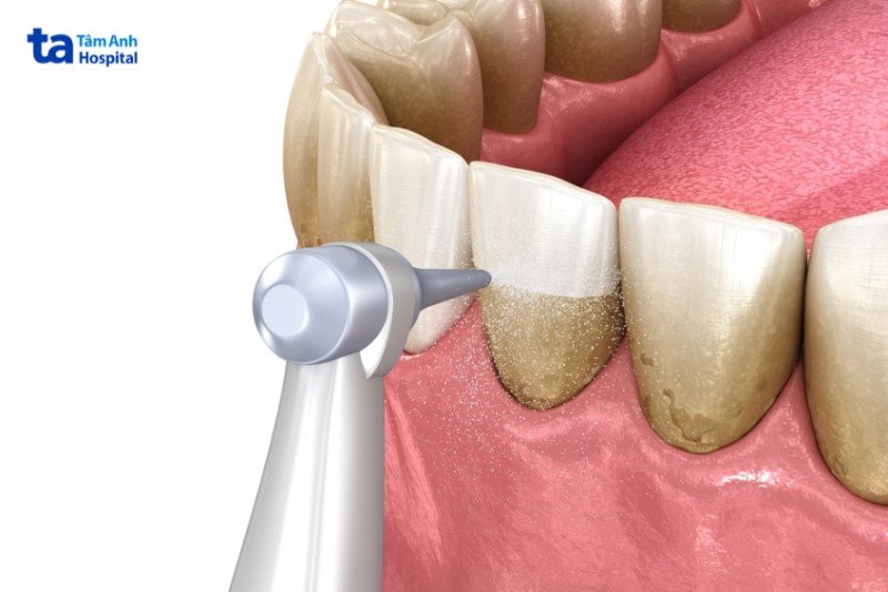 Răng lung lay trong giấc mơ ý nghĩa điềm báo