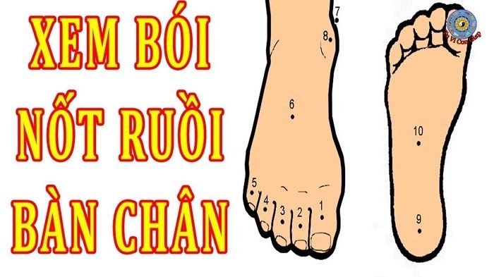 Nốt ruồi ở lòng bàn chân