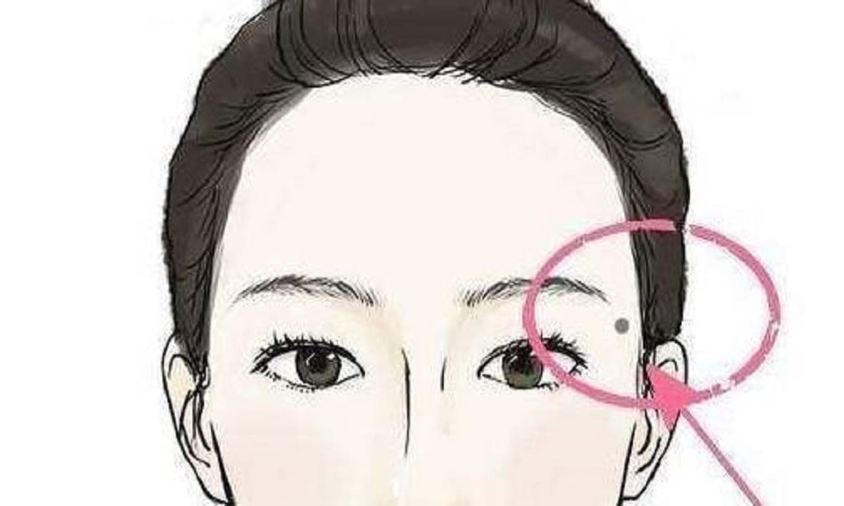 Ảnh tổng hợp các vị trí nốt ruồi