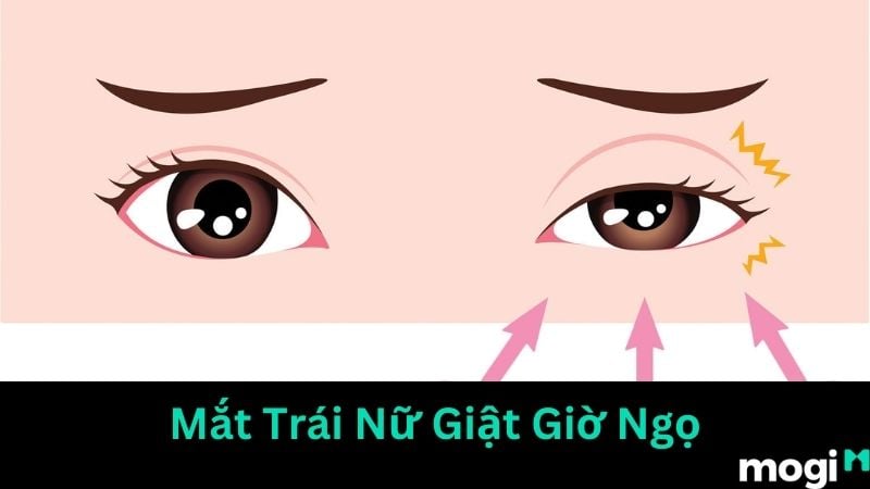 Mắt trái giật theo thời gian