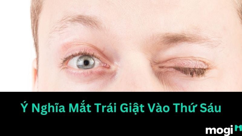 Hiện tượng mắt trái giật theo giờ