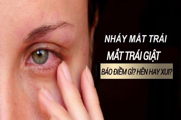 Minh họa hiện tượng nháy mắt