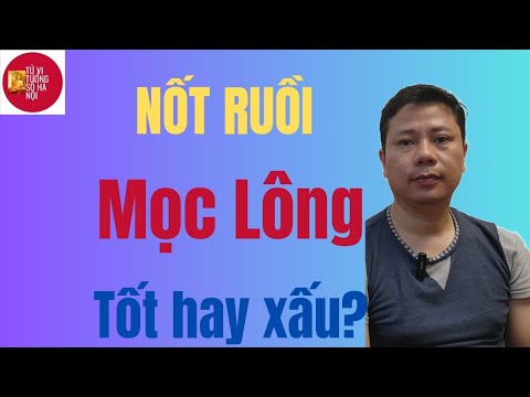 Nốt ruồi mọc lông tốt hay xấu