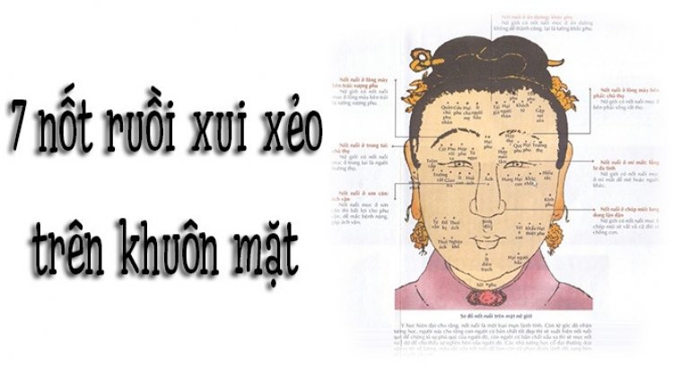 Vị trí nốt ruồi cần cân nhắc xóa
