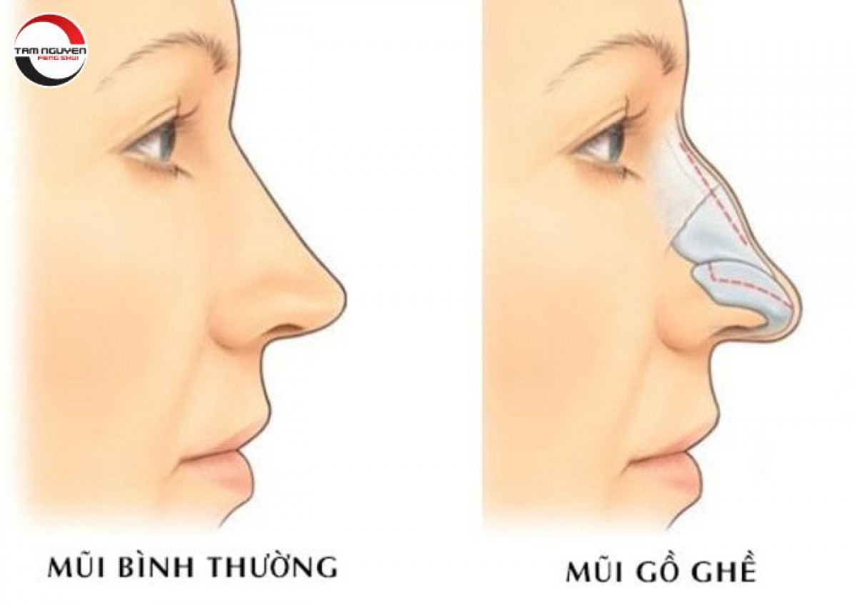 Gương mặt với mũi cao nổi bật