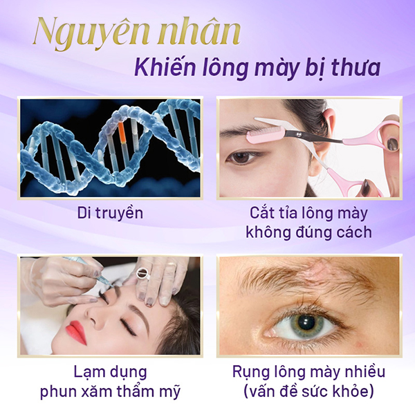 Lông mày thưa và giải pháp