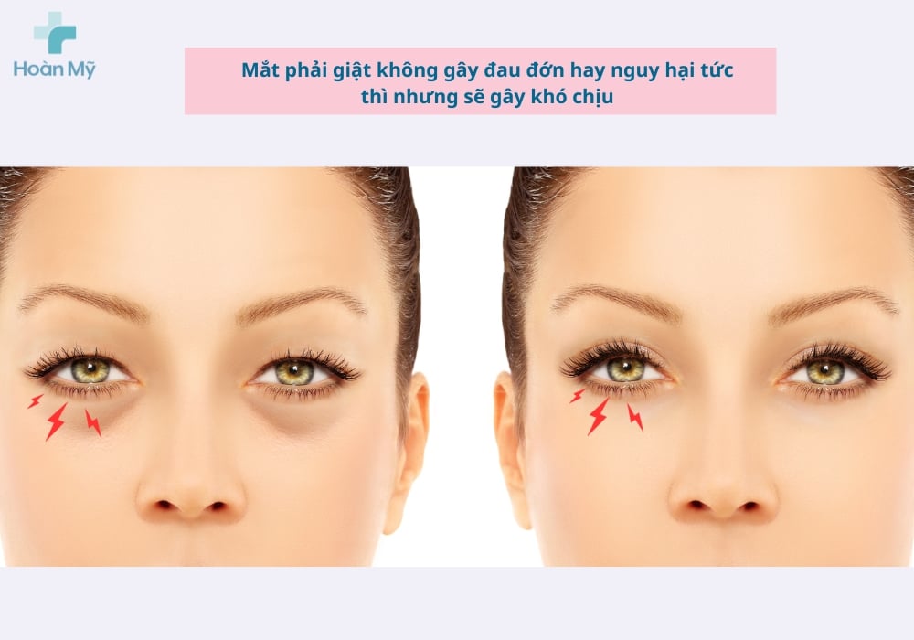 Ảnh minh họa mắt phải giật liên tục