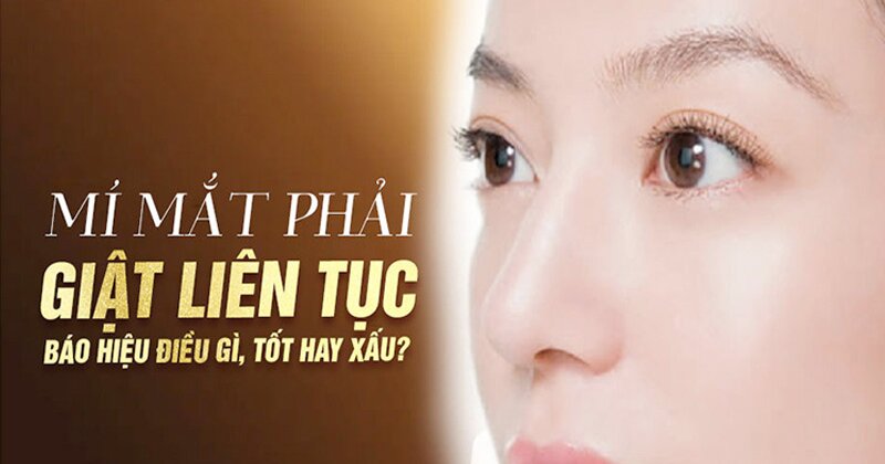 Mắt phải giật ở phụ nữ