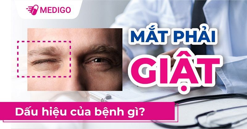 Co giật mí mắt phải
