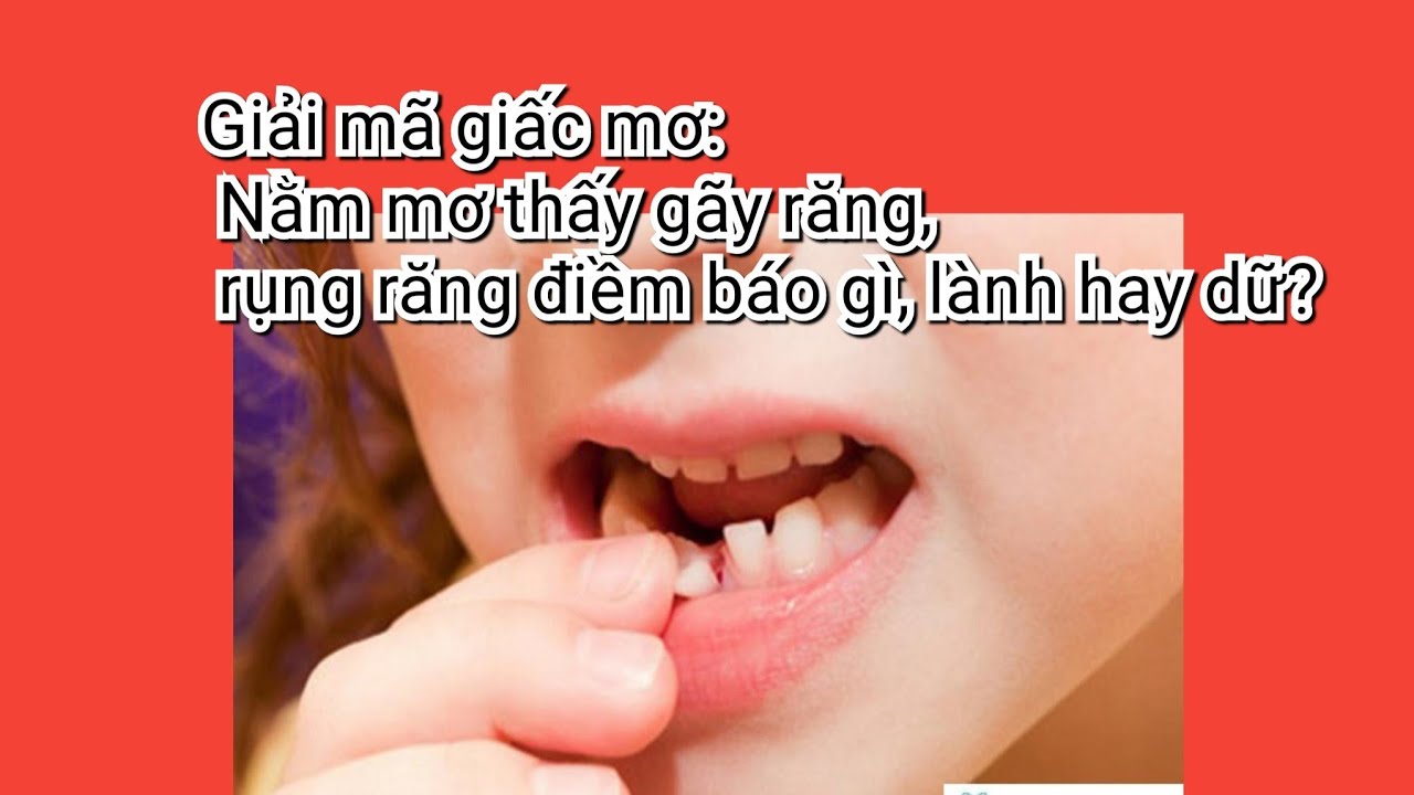 Người nằm mơ thấy gãy răng trong giấc ngủ