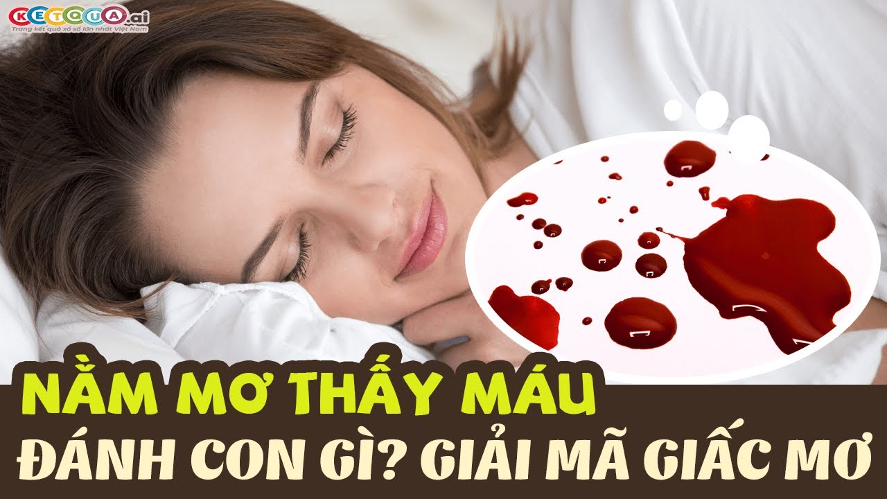 Người nằm mơ thấy máu chảy trong giấc ngủ