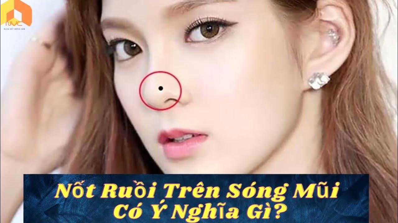 Nốt ruồi trên sống mũi nam nữ