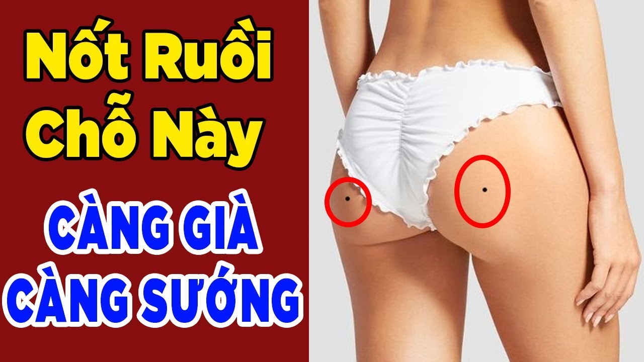 Nốt ruồi ở mông phụ nữ