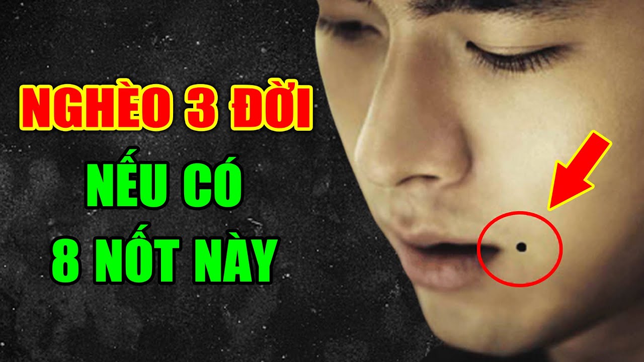 Vị trí nốt ruồi hiếm trên khuôn mặt