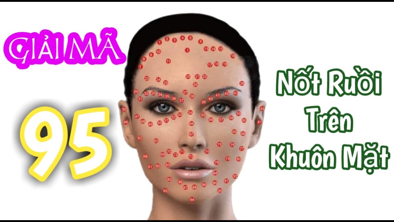Các dạng nốt ruồi trên mặt người