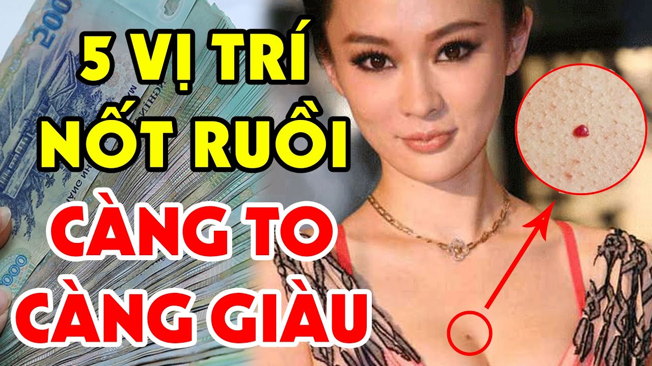 Nốt ruồi trước ngực phụ nữ