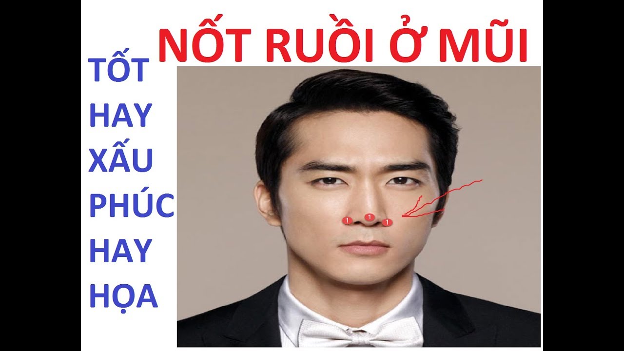 Nốt ruồi đầu mũi nam giới