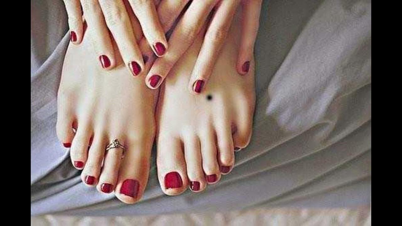 Hình ảnh nốt ruồi ở gót chân phải