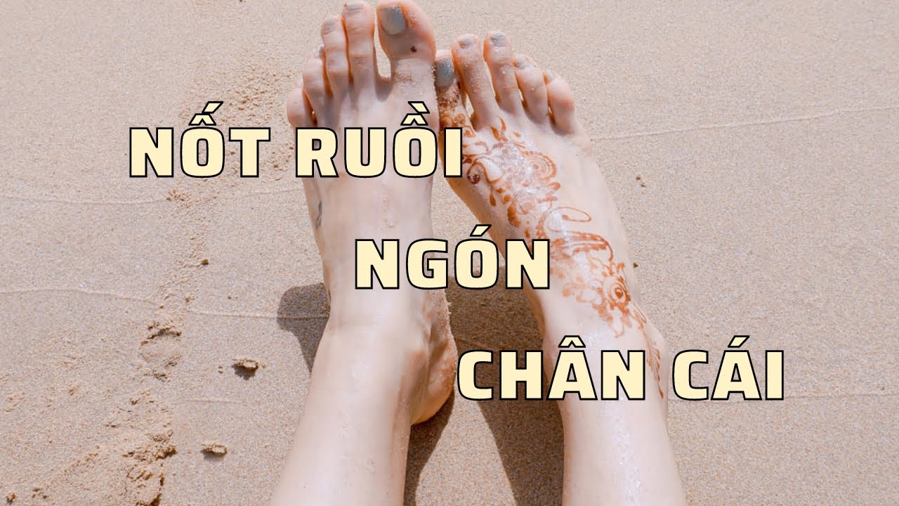 Ý nghĩa nốt ruồi ngón chân cái