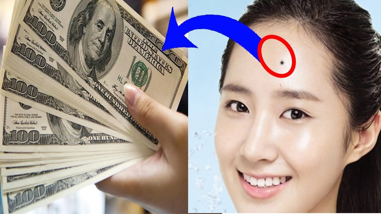 Nốt ruồi trên trán và mặt đàn ông