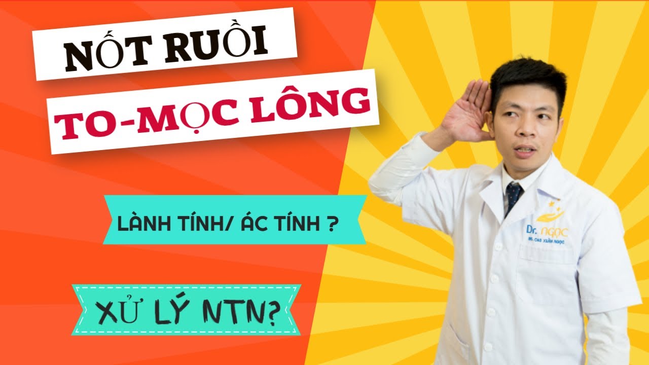 Nốt ruồi to có lông mọc