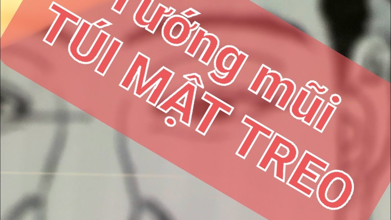 Tướng mũi liên quan phú quý