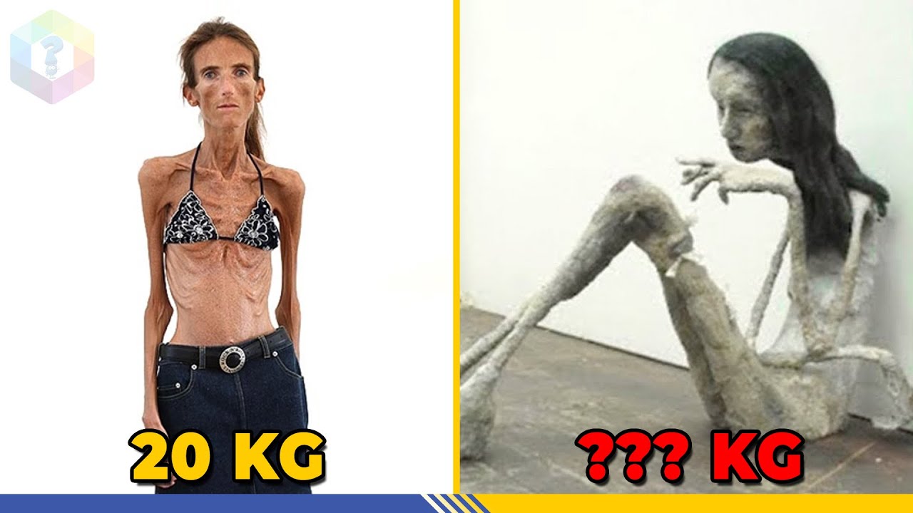 Những người có thân hình rất gầy