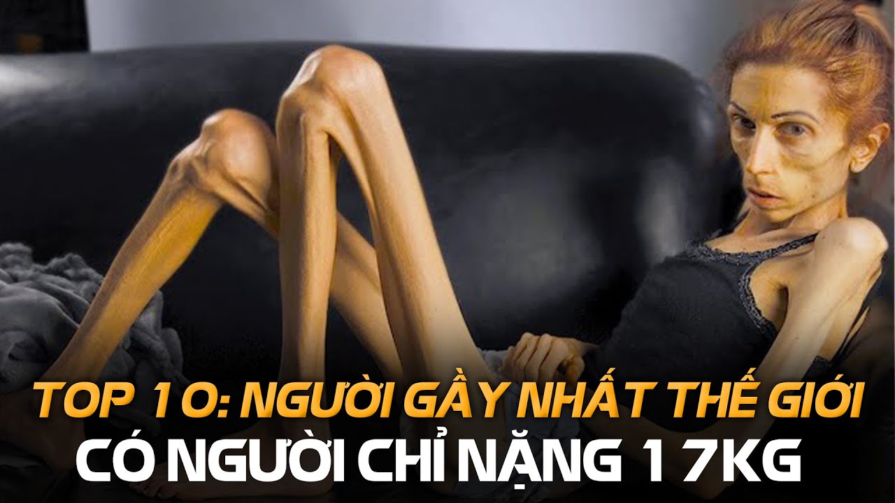 Người gầy trên thế giới